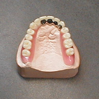 Freier Gaumen